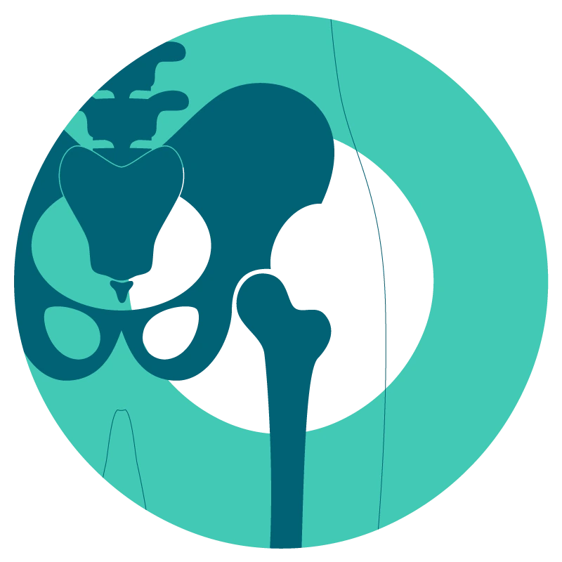 Trattamento ortopedico mininvasivo per anca e bacino