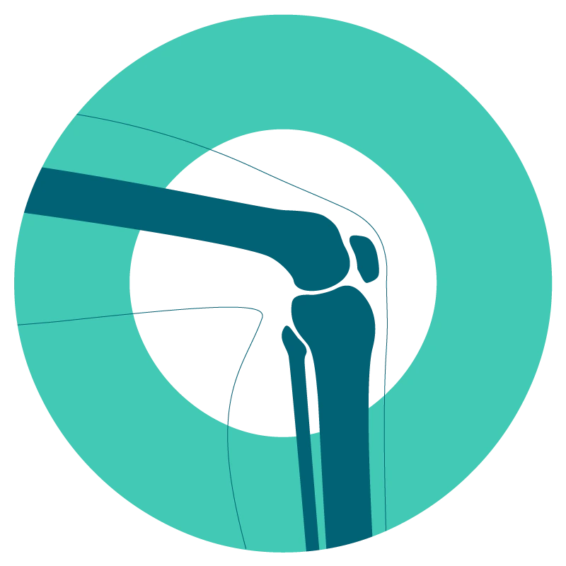 Trattamenti avanzati per il ginocchio – protesi, artroscopia e terapie conservative da Ortoclinic Torino