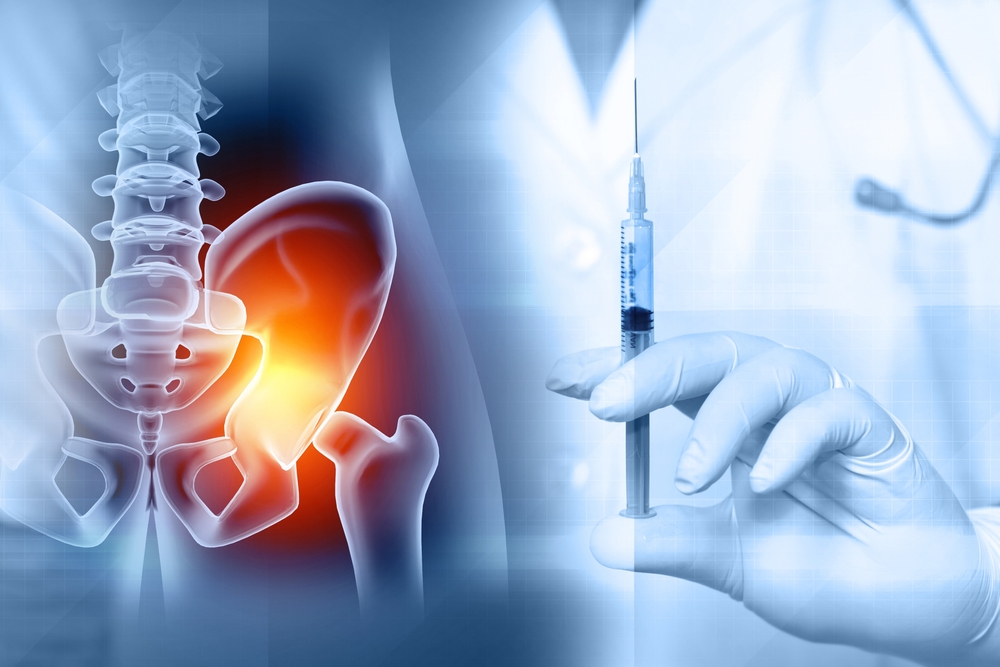 Radiografia dell’anca con siringa per trattamenti infiltrativi