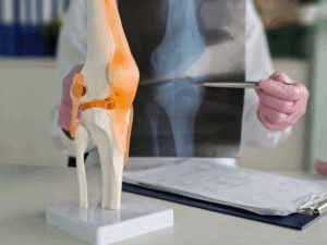 Ortopedico mostra una radiografia del ginocchio a un paziente durante la visita.