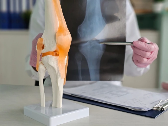 Ortopedico mostra una radiografia del ginocchio a un paziente durante la visita.